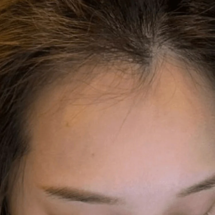 After